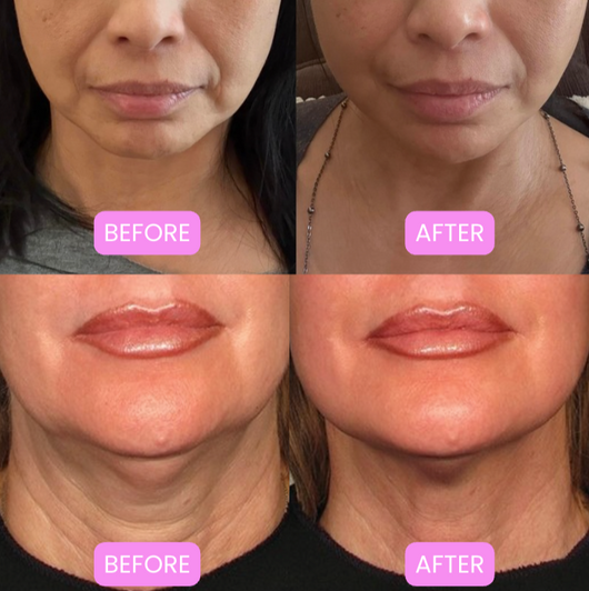 Lumlys Boosterpro 2.0®